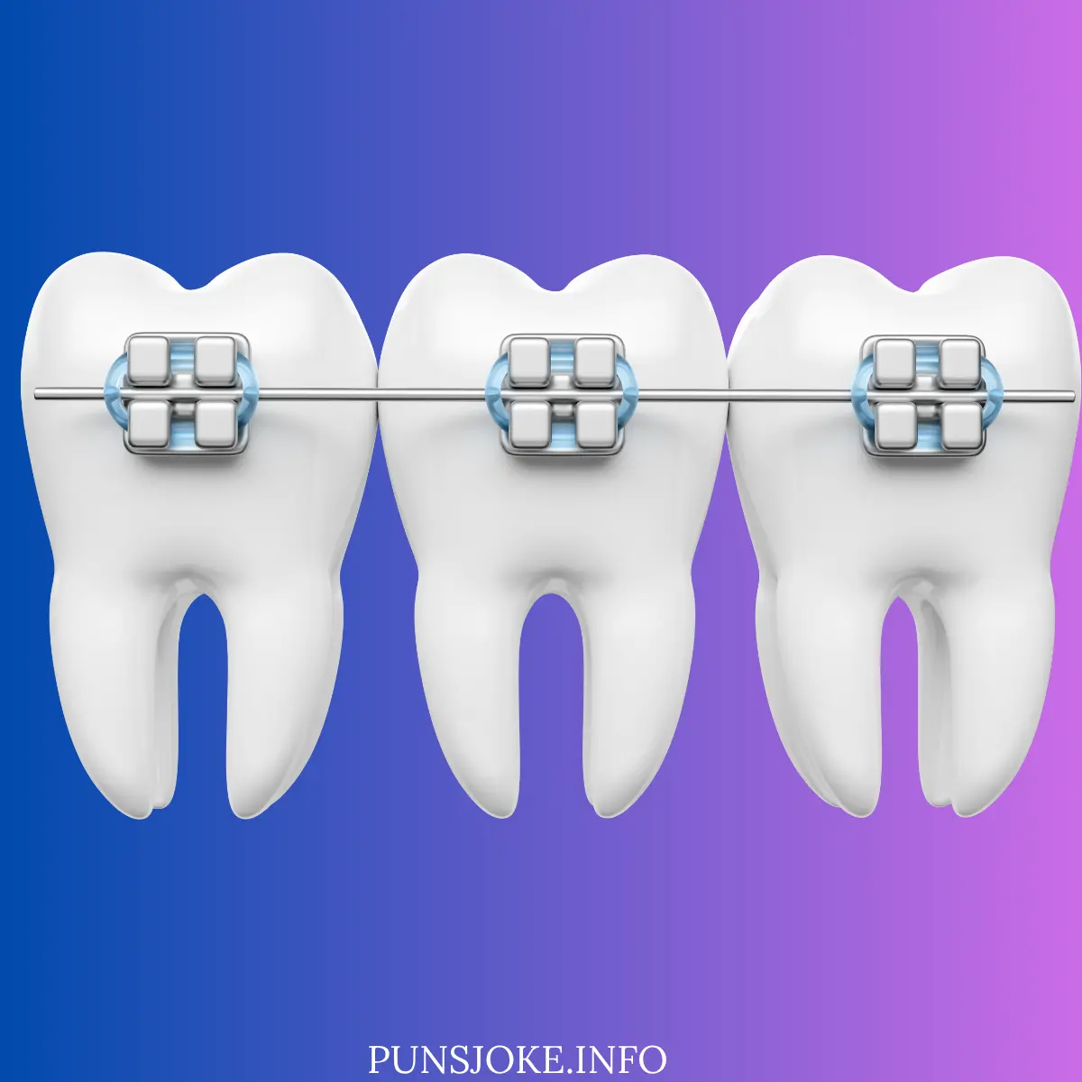 brace-yourself-for-these-orthodontic-one-liners